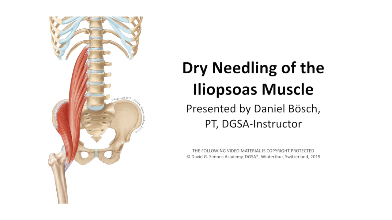 Dry Needling - Precise, Safe and Effective: David G. Simons Academy, DGSA®